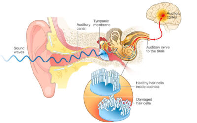 The 7 Most Dangerous Myths About Tinnitus