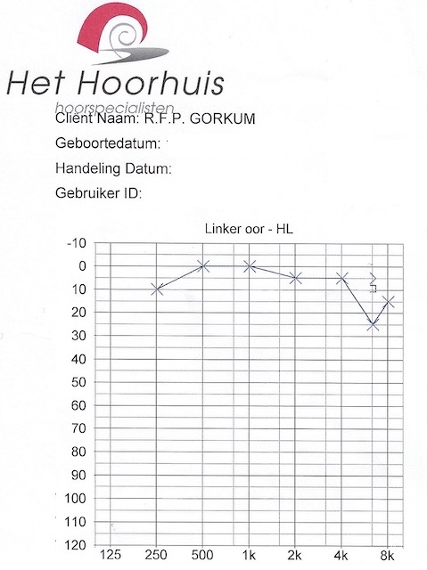 Gehoortest van Roel van Gorkum die hij bij de audioloog heeft laten uitvoeren toont een lichte gehoorbeschadiging in zijn linker oor