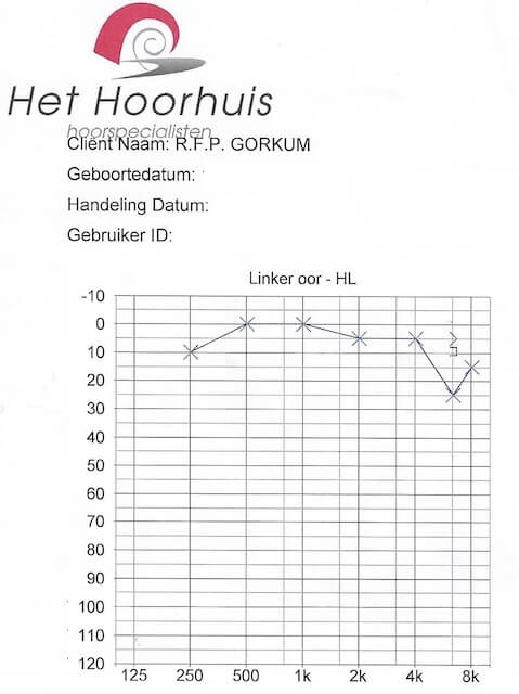 Audiogram van Roel van Gorkum, oprichter van Still Tinnitus, waarop gehoorschade zichtbaar is rond de 7000 Hz.