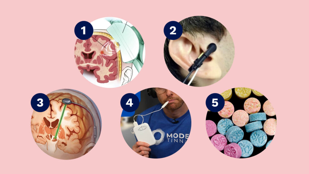 Overview of five experimental tinnitus treatments, including brain stimulation, ear and tongue devices, and MDMA trials.