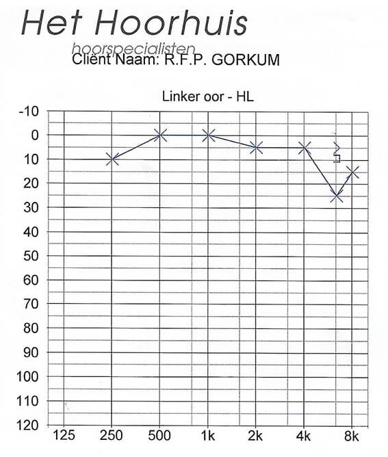 Grafiek die een gehoortestresultaat voor het linker oor toont, gelabeld als ‘Linker oor (left ear)’, met frequentie op de x-as (van 125 Hz tot 8 kHz) en het gehoorniveau in decibel op de y-as. Gemarkeerde punten geven de testresultaten bij verschillende frequenties weer.